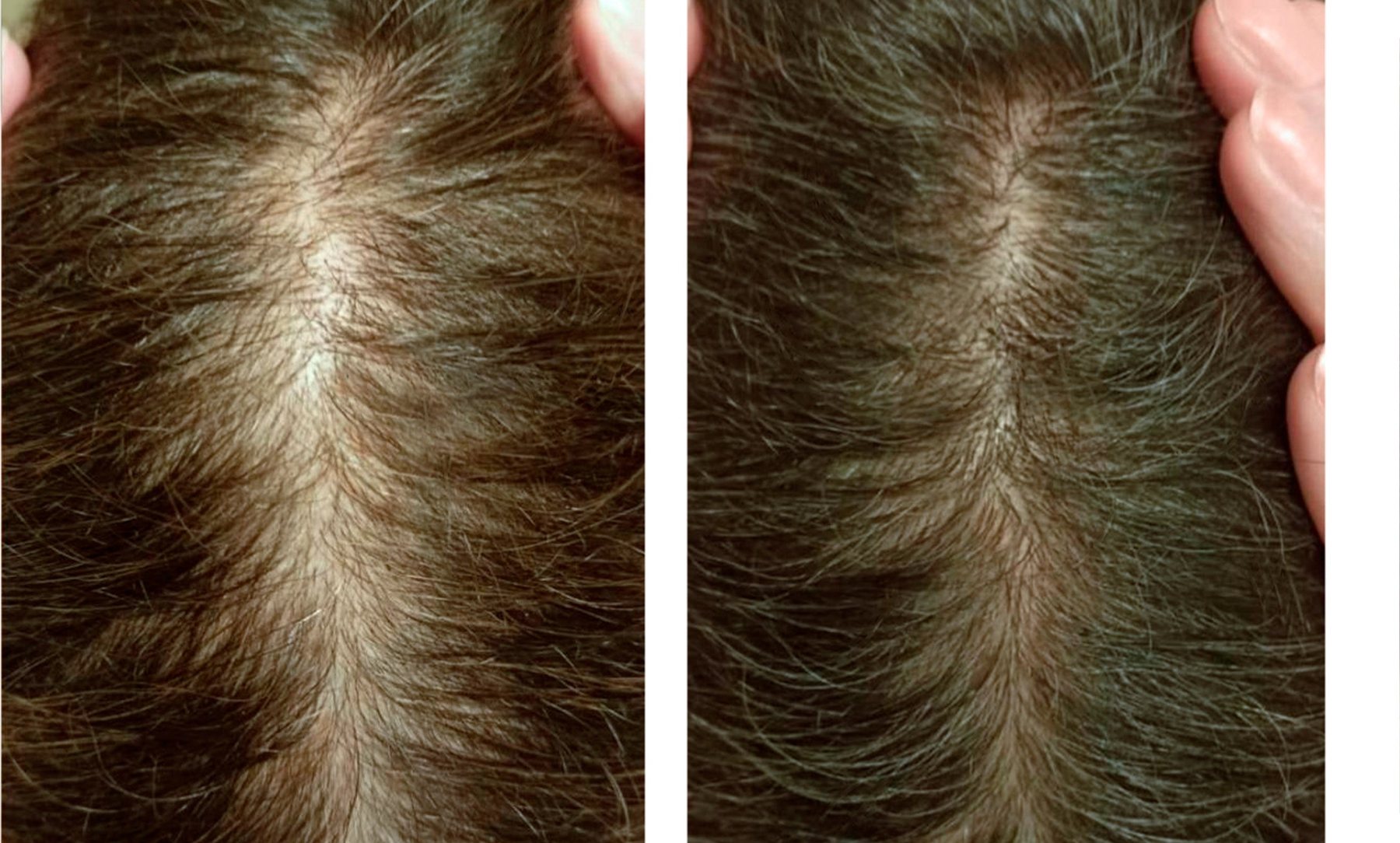 Raie sur cheveux châtains, avant et après