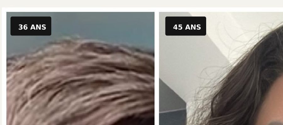 Les cheveux de Natallia à 36 ans, gris, et à 45 ans, bruns