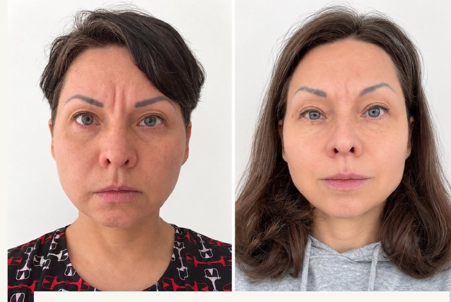 Natallia à 41 ans et à 45 ans