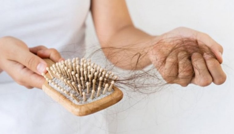 Des mains tiennent une brosse et des cheveux tombés