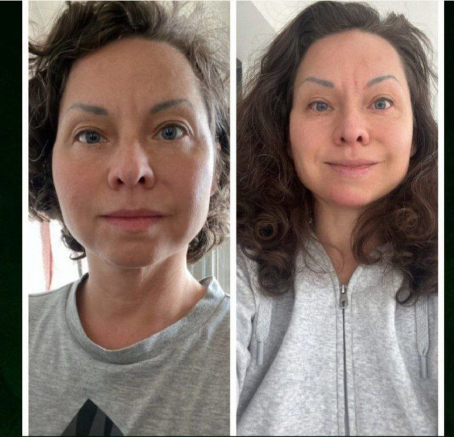 Natallia à 42 ans et à 45 ans